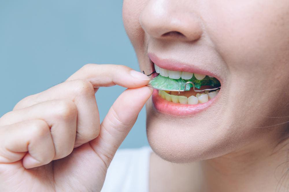 Heim Orthodontics Heim Orthodontics