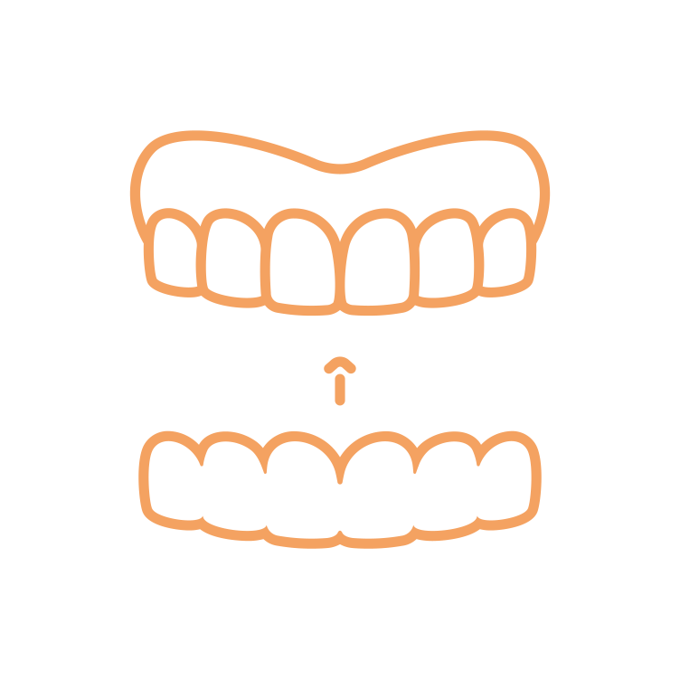 Invisalign Invisalign