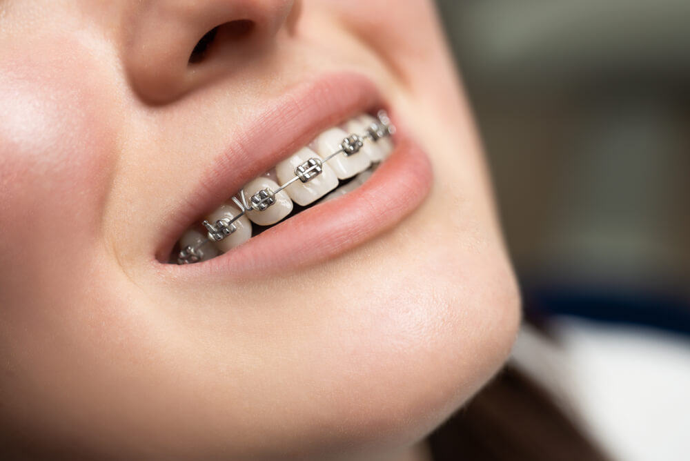 Heim Orthodontics Heim Orthodontics